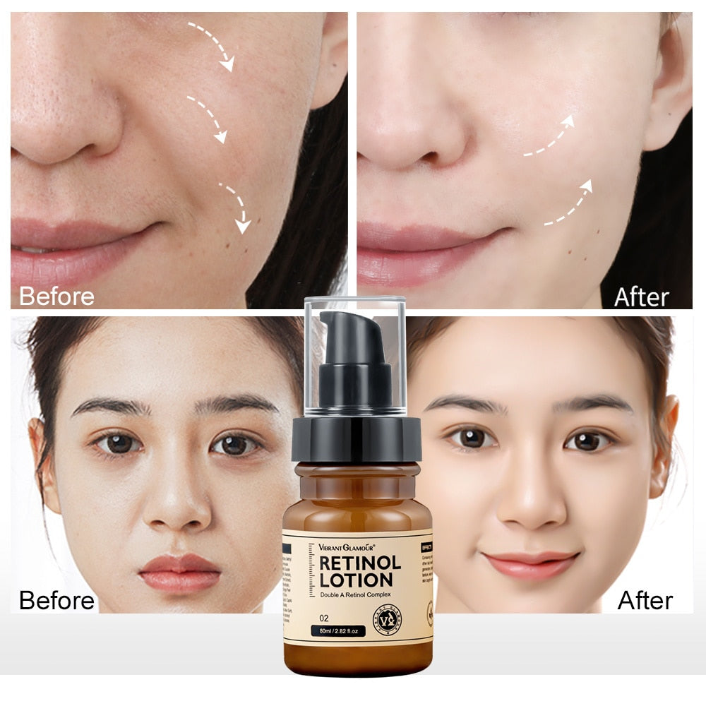 Retinol Face Lotion to Fight Aging